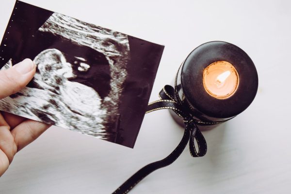 Therapist Explains Grief, Silence and Healing After Infant Loss