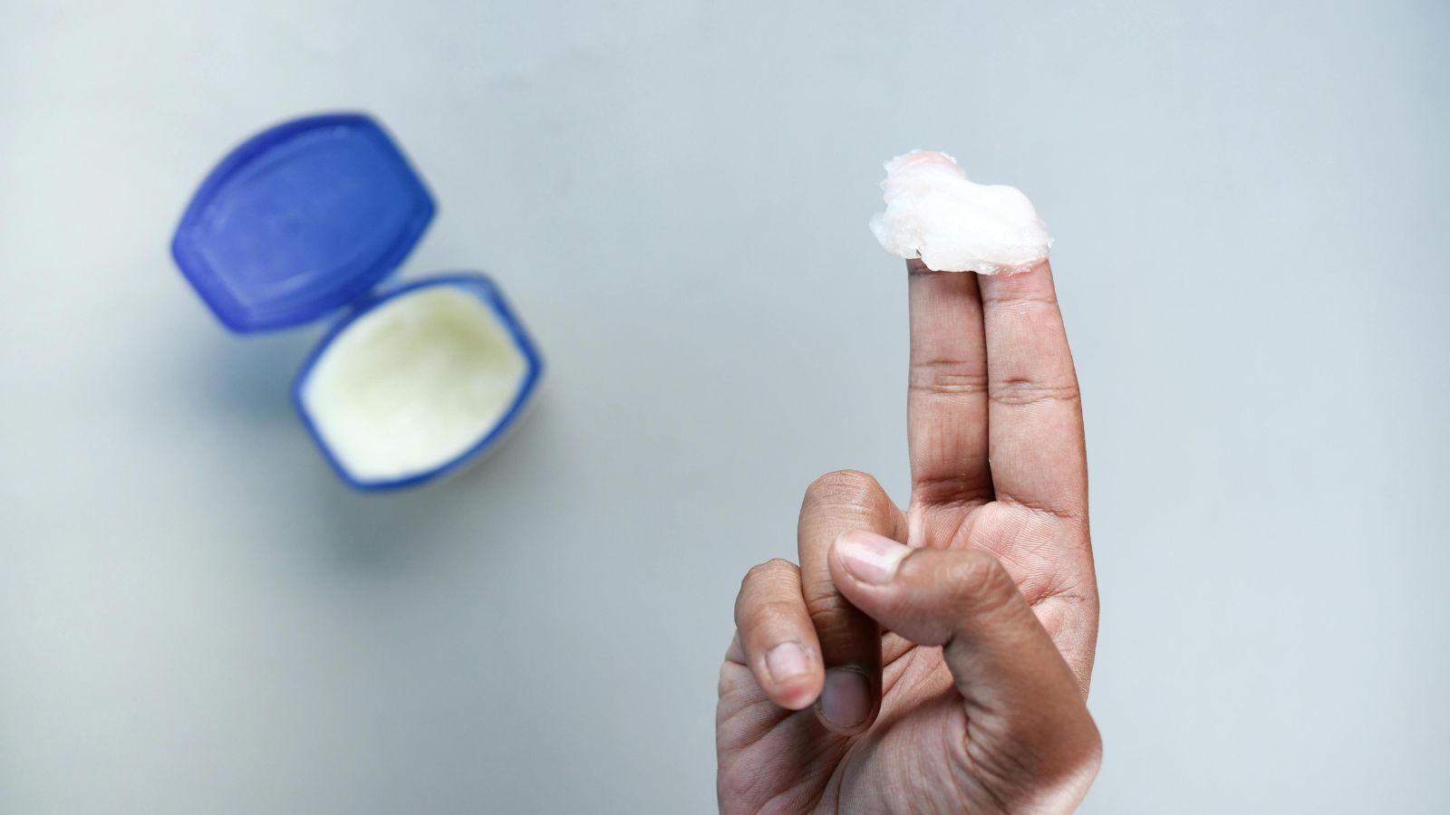 Can Vicks VapoRub Really Cure a Migraine?