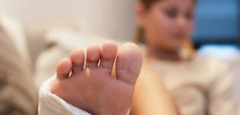 girl broken leg